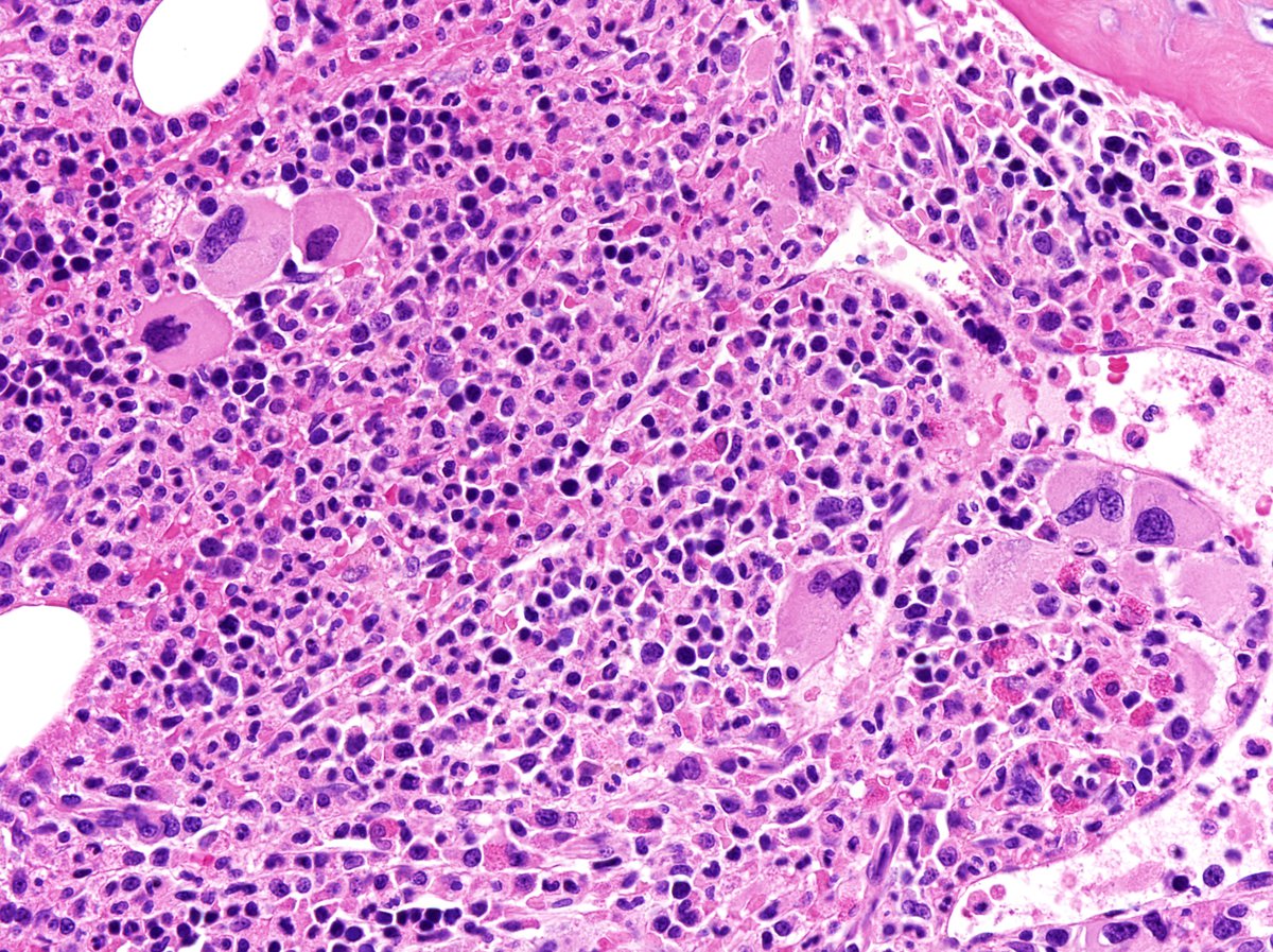 Higher magnification
